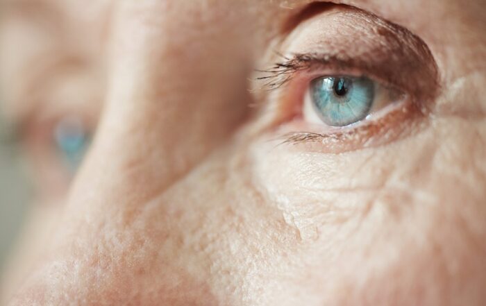 Como limpiar correctamente una prótesis en el ojo